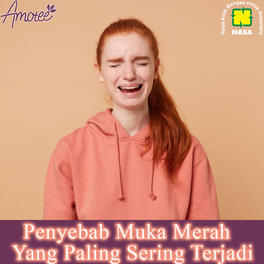 Apa itu hot flashes (muka merah)