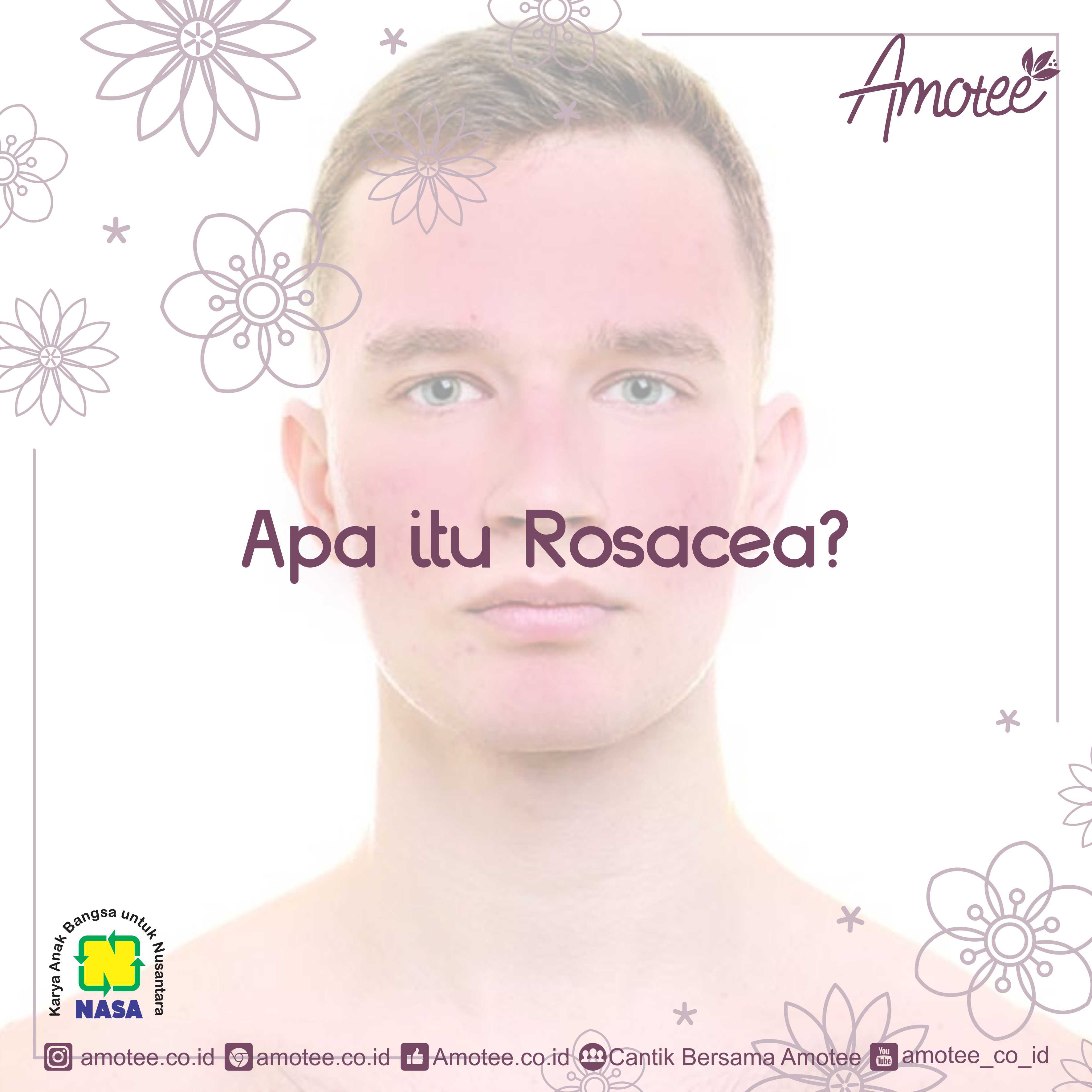 Apa itu rosacea