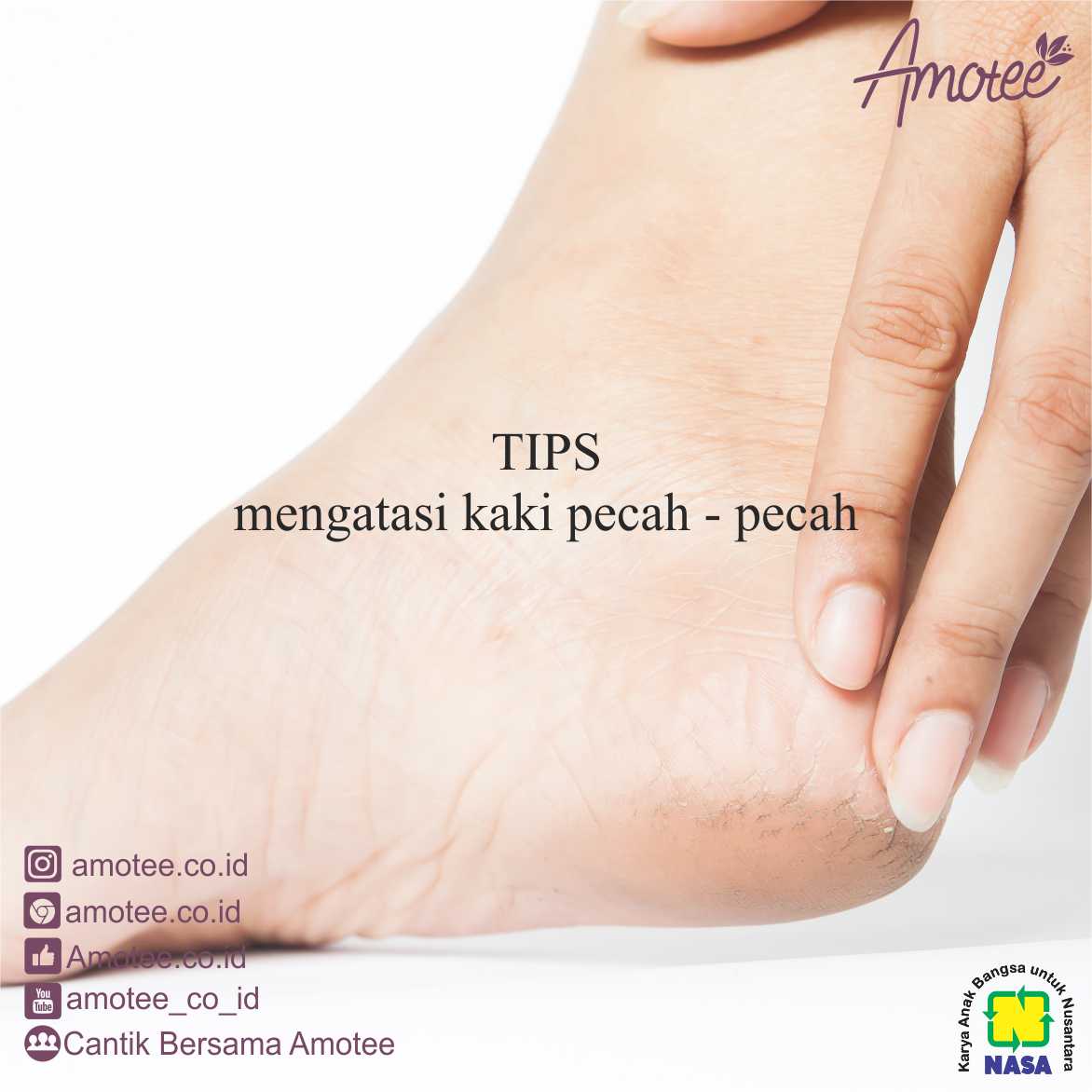 Mengatasi Kaki Pecah-pecah