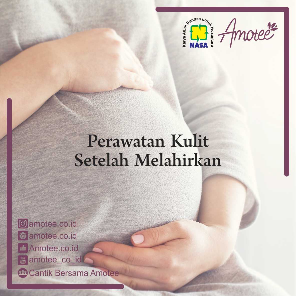 Merawat Kulit Setelah Melahirkan