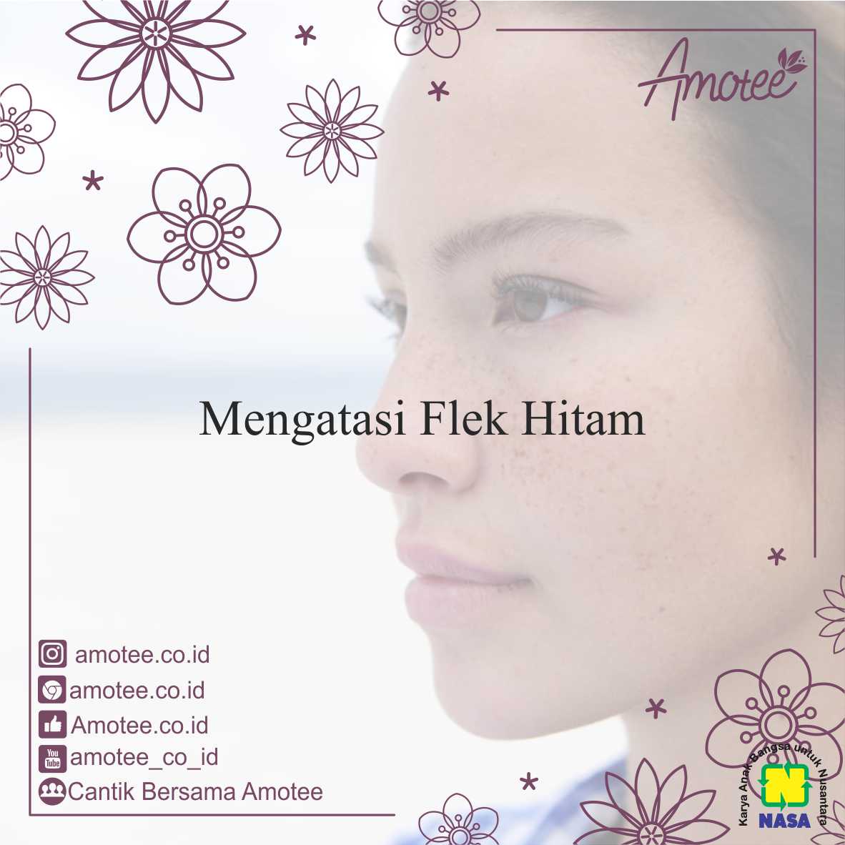 Mengatasi Flek Hitam