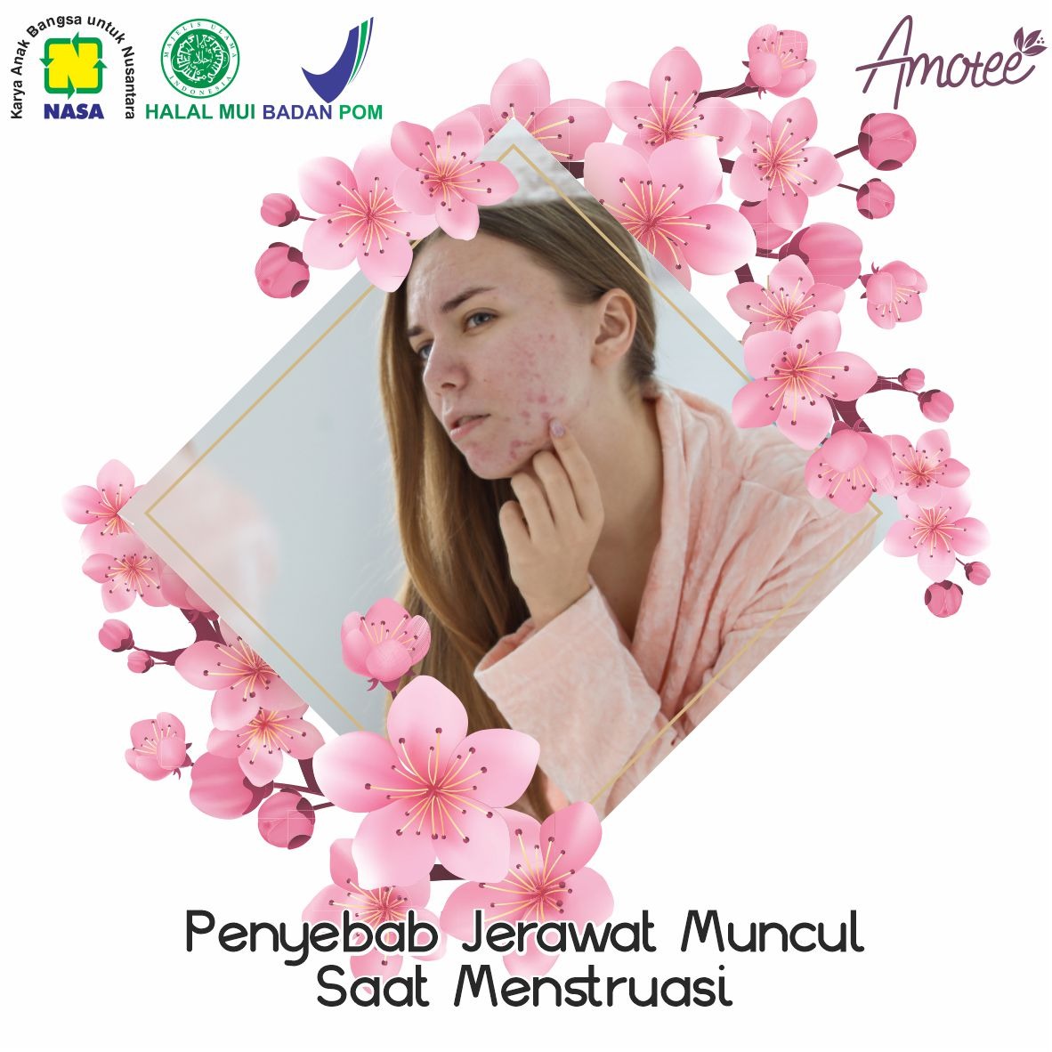 Penyebab Jerawat Muncul Saat Menstruasi