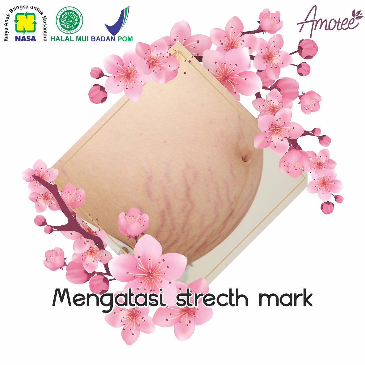 Mengatasi dan Mencegah Stretch Mark